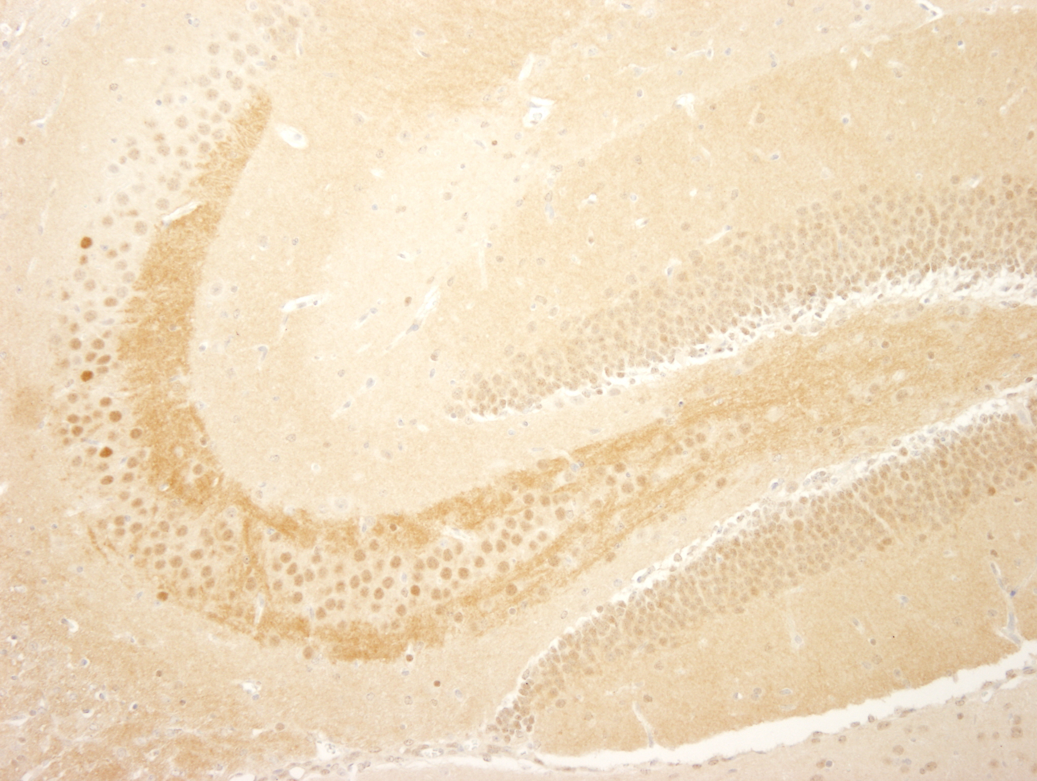Detection of mouse TORC1 by immunohistochemistry.