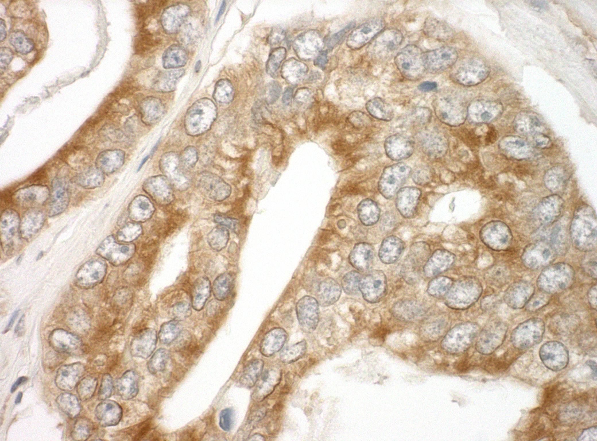 Rabbit anti-EB1 IHC Antibody
