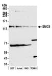 Detection of human and mouse SMC5 by western blot.