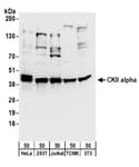Detection of human and mouse CKII alpha by western blot.