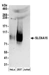 Detection of human SLC6A15 by western blot.