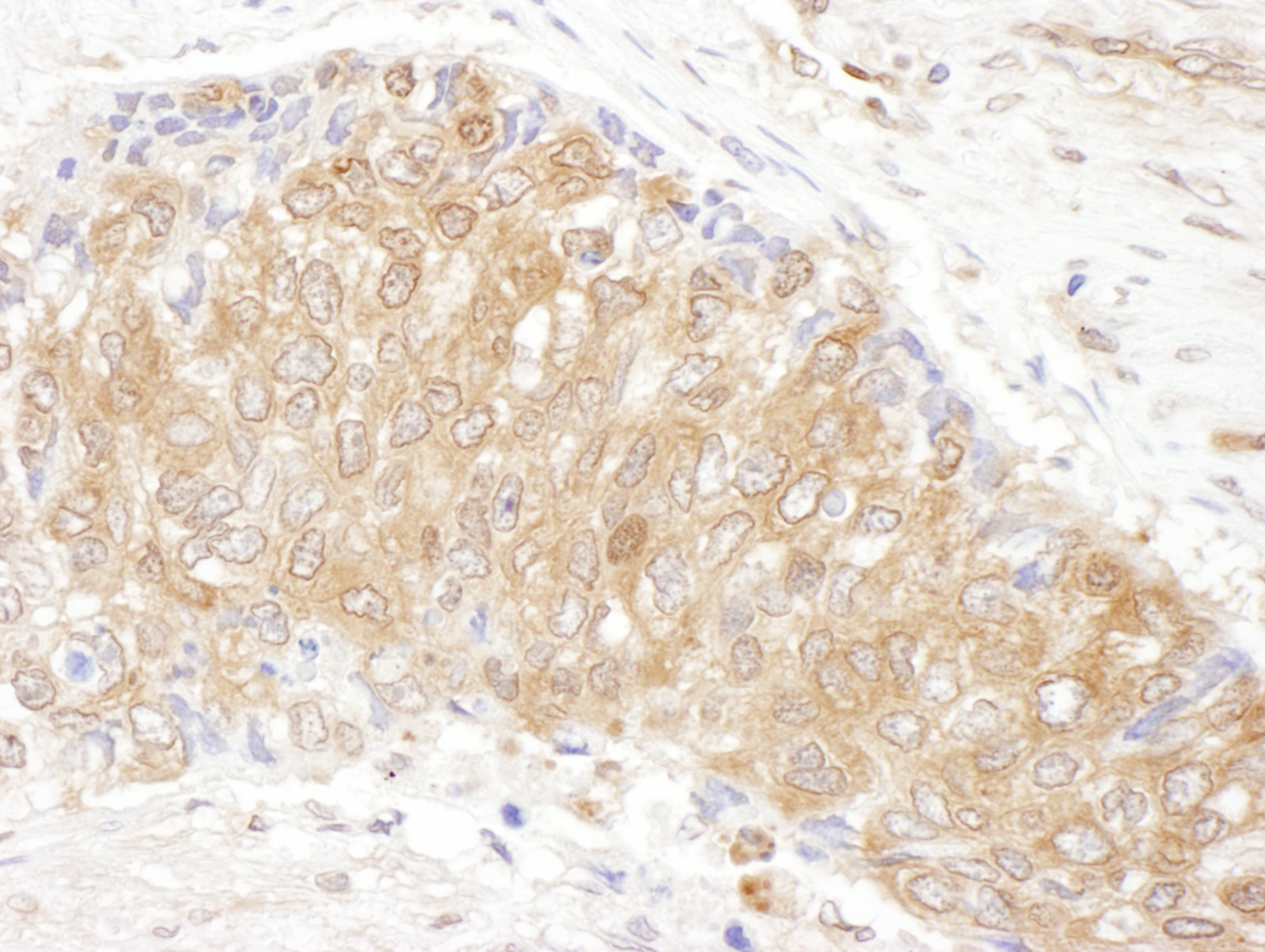 Detection of human CCT3 by immunohistochemistry.