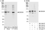 Detection of human DDX24 by western blot and immunoprecipitation.