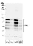 Detection of human PML by western blot.