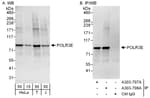 Detection of human POLR3E by western blot and immunoprecipitation.