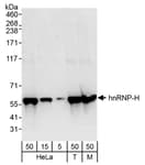 Detection of human and mouse hnRNP-H by western blot.