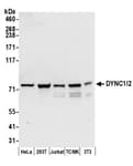Detection of human and mouse DYNC1I2 by western blot.