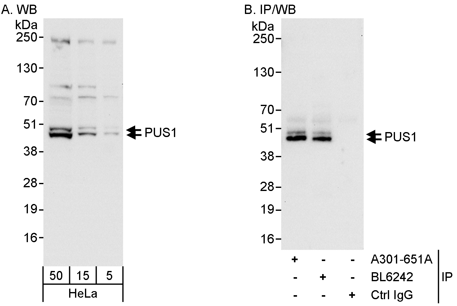 Detection of human PUS1 by western blot and immunoprecipitation.