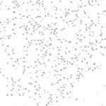 Detection of human CD2 by immunocytochemistry.