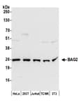 Detection of human and mouse BAG2 by western blot.