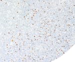 Detection of human TIA-1 by immunohistochemistry.