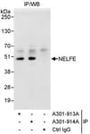 Detection of human NELFE by western blot of immunoprecipitates.