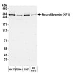 Detection of mouse Neurofibromin (NF1) by western blot.