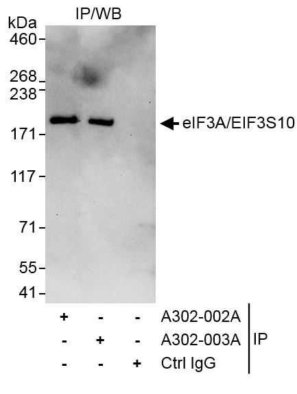 Detection of human eIF3A/EIF3S10 by western blot of immunoprecipitates (h).