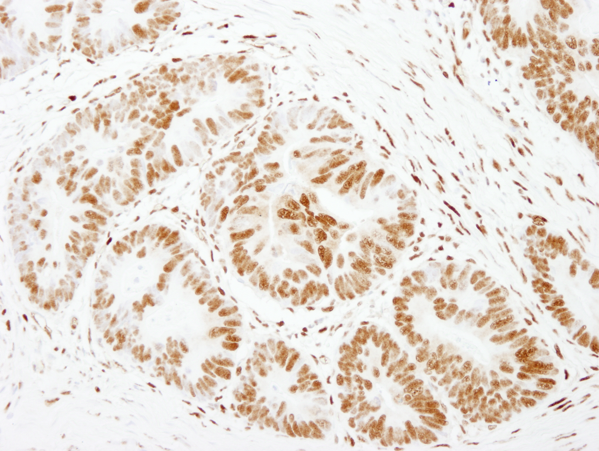 Rabbit anti-FOXK1 IHC Antibody