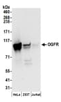 Detection of human OGFR by western blot.