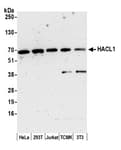 Detection of human and mouse HACL1 by western blot.