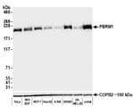 Detection of human PBRM1 by western blot.