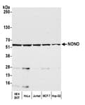Detection of human NONO by western blot.