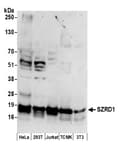 Detection of human and mouse SZRD1 by western blot.