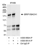 Detection of human BRIP1/BACH1 by western blot of immunoprecipitates.