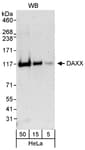 Detection of human DAXX by western blot.