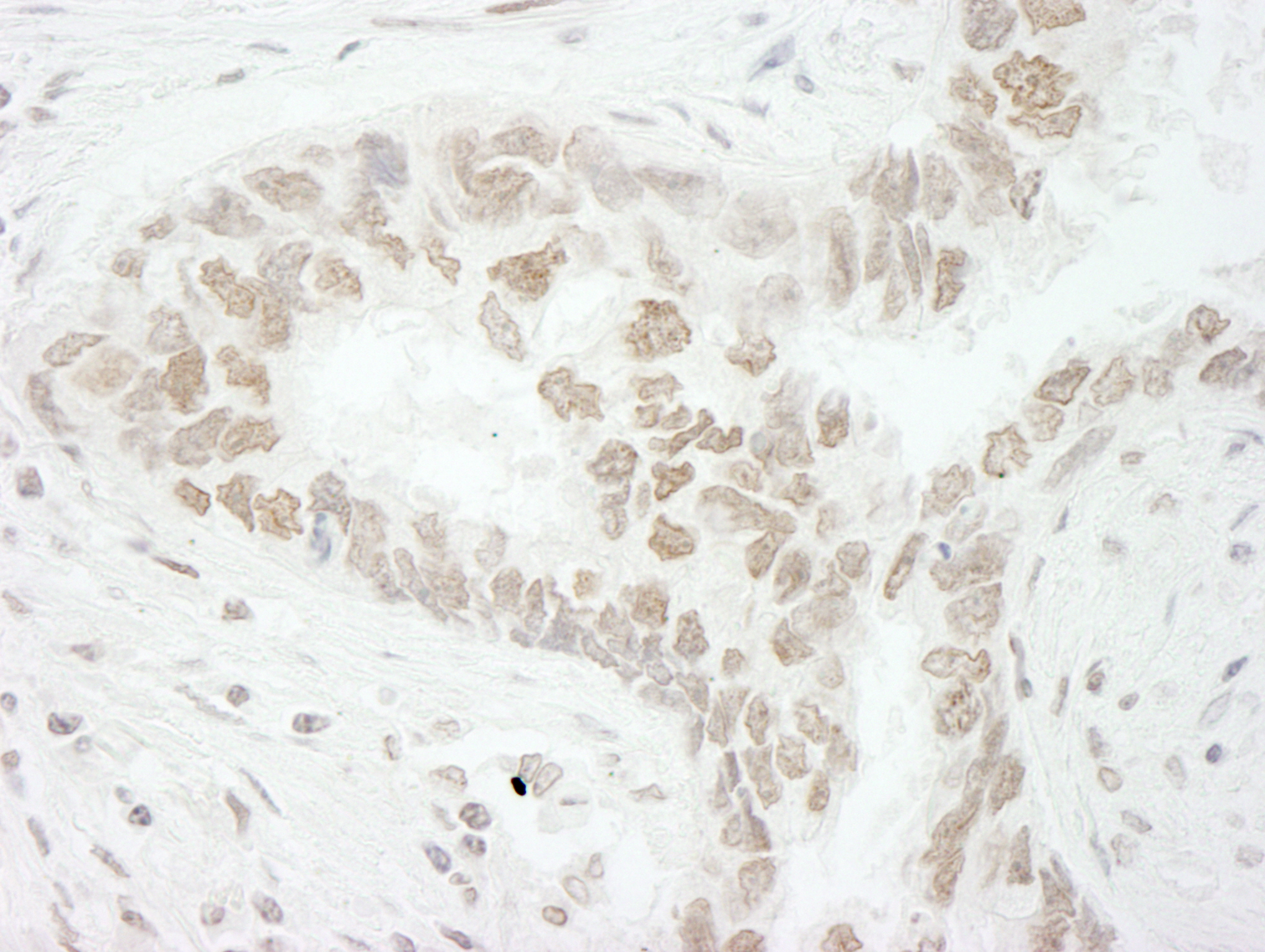 Detection of human PAF49 by immunohistochemistry.