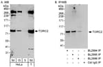 Detection of human TORC2 by western blot and immunoprecipitation.