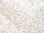 Detection of human DHX33 by immunohistochemistry.