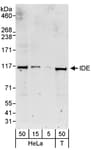 Detection of human IDE by western blot.