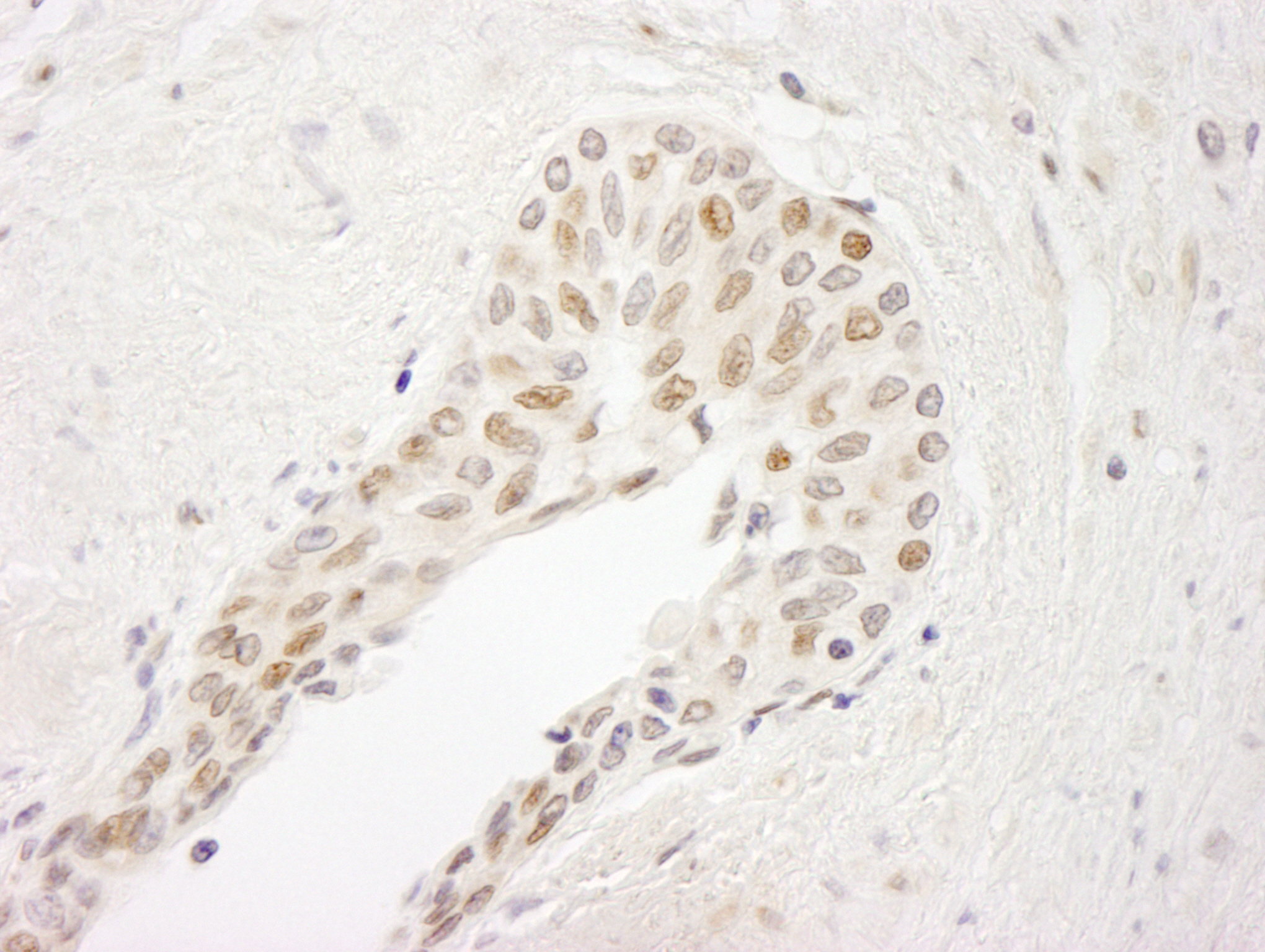 Rabbit anti-ATRIP IHC Antibody