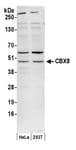 Detection of human CBX8 by western blot.