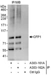 Detection of human CFP1 by western blot of immunoprecipitates.