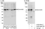 Detection of human and mouse Synoviolin by western blot (h&amp;m) and immunoprecipitation (h).
