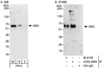 Detection of human ABI2 by western blot and immunoprecipitation.
