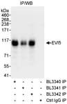 Detection of human EVI5 by western blot of immunoprecipitates.