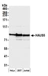Detection of human HAUS5 by western blot.