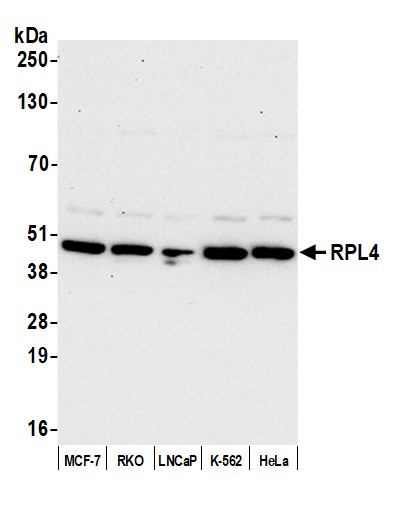 Detection of human RPL4 by western blot.