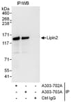 Detection of human Lipin2 by western blot of immunoprecipitates.