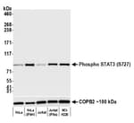 Detection of human Phospho STAT3 (S727) by western blot.