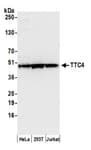 Detection of human TTC4 by western blot.