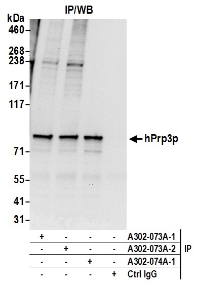 Detection of human hPrp3p by western blot of immunoprecipitates.