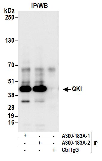 Detection of human QKI by western blot of immunoprecipitates.