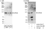 Detection of human SPICE by western blot and immunoprecipitation.