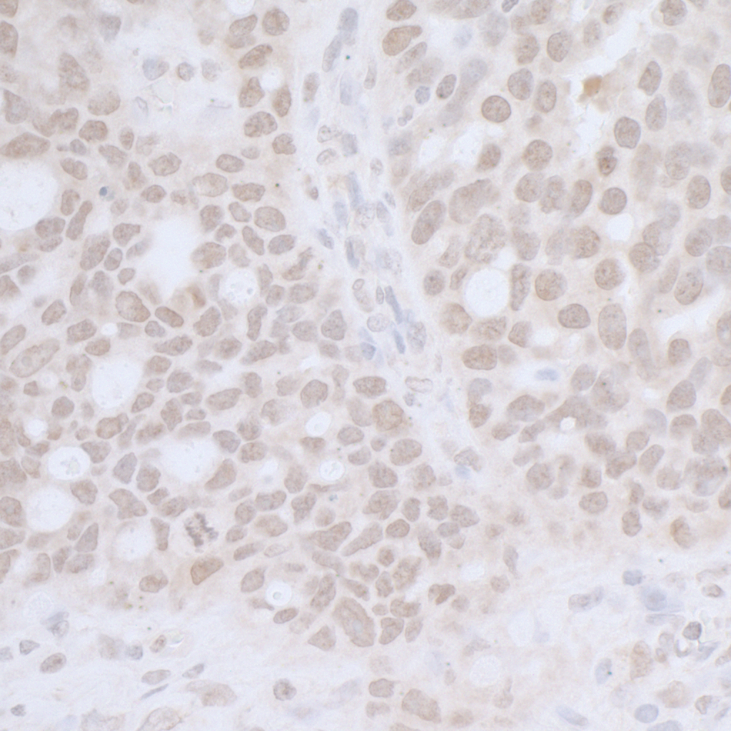Rabbit anti-CTR9 IHC Antibody