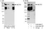 Detection of human HECTD1 by western blot and immunoprecipitation.