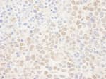 Detection of mouse NAT10 by immunohistochemistry.