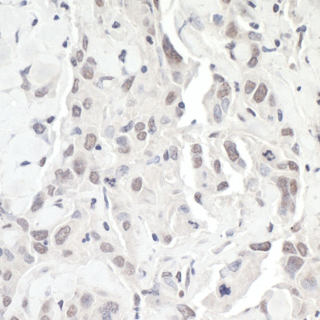 Rabbit anti-ZEB1 IHC Antibody