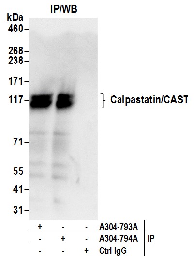 Detection of human Calpastatin/CAST by western blot of immunoprecipitates.