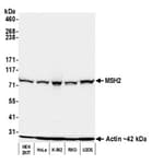 Detection of human MSH2 by western blot.